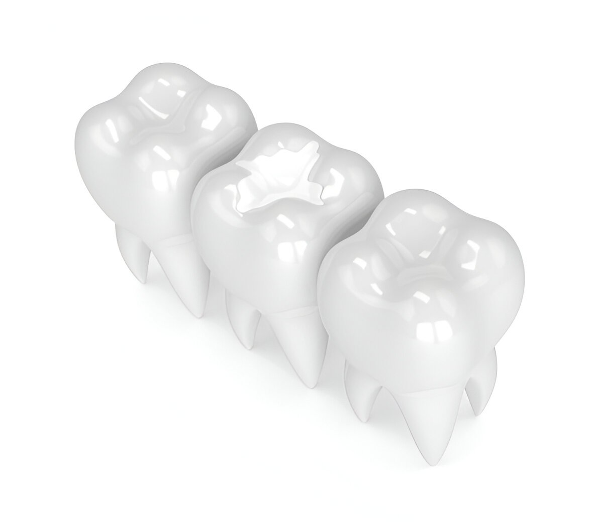 dental fillings in pickering