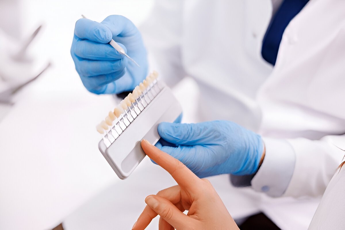 dental veneers in pickering