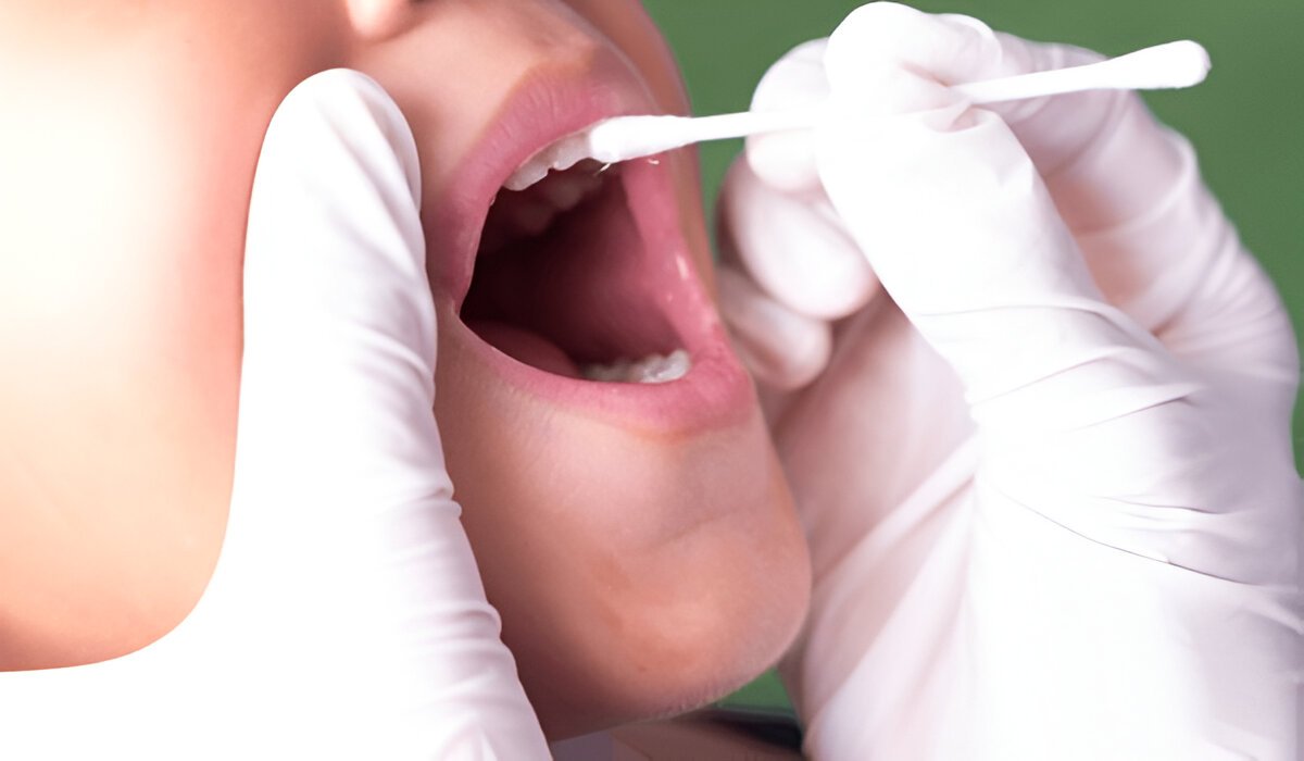 fluoride treatment in pickering