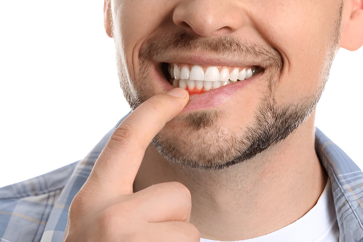 gum disease treatment near you