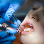 maxillofacial-surgery
